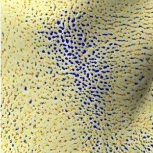奈米氣泡蓮蓬頭管經實驗室檢測，針對毛孔改善使用前的效果圖示