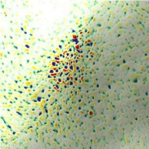 奈米氣泡蓮蓬頭管經實驗室檢測，針對肌膚紋理使用二週後的效果圖示
